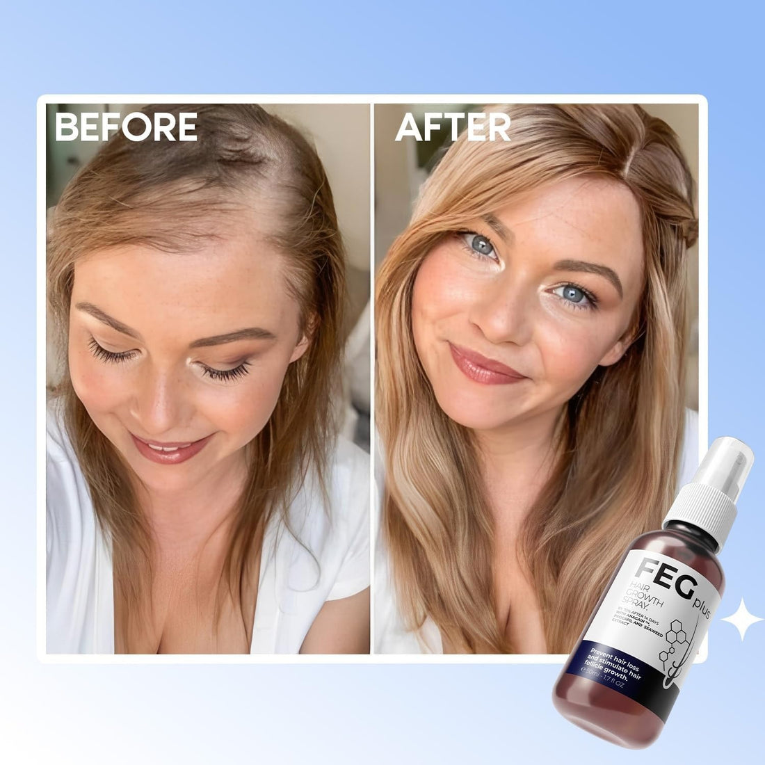 FEG PLUS Hair Growth Spray 50ml