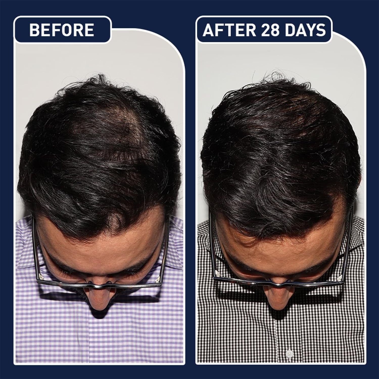 FEG PLUS Hair Growth Spray 50ml